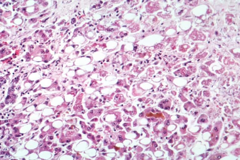 Name:  mysterious-child-hepatitis-outbreak-warning-c.jpg
Views: 8344
Size:  53.1 KB
